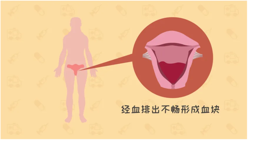 经血颜色深有血块，是妇科病？