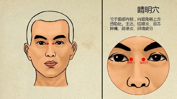中医认为玫瑰痤疮是什么原因引起的