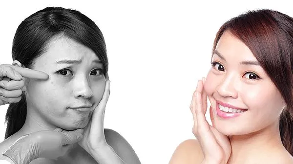 产后容易得皮肤病