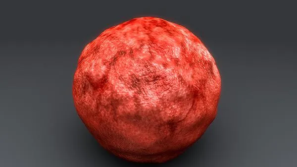 前庭大腺囊肿病因有哪些