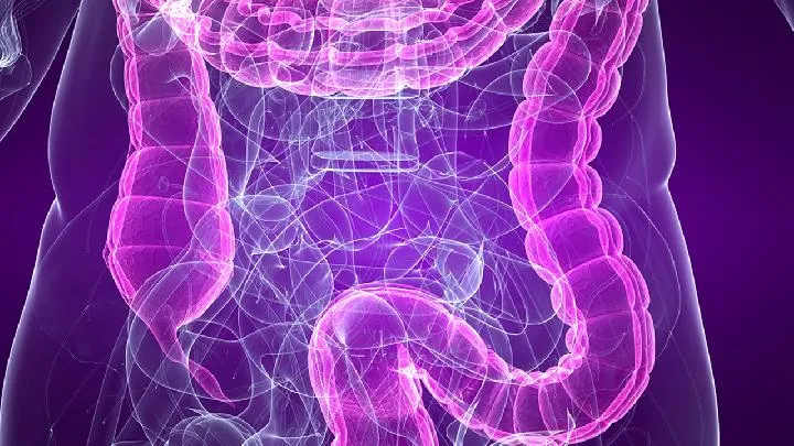 慢性肠炎的诊断标准