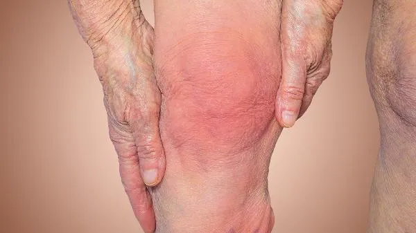 中医治疗老年人骨质增生的效果怎么样