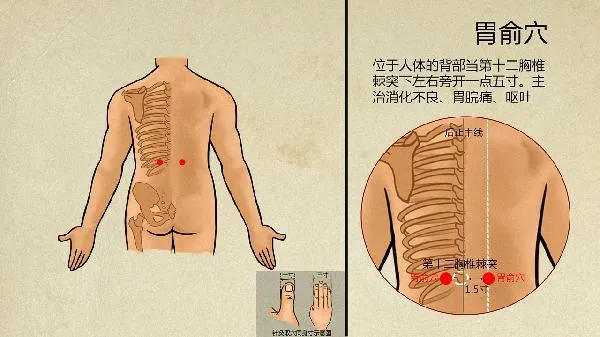 中医认为头皮癣是什么原因引起的