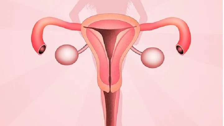 女性反复人流会造成宫外孕吗 中医辨证分型来治疗宫外孕