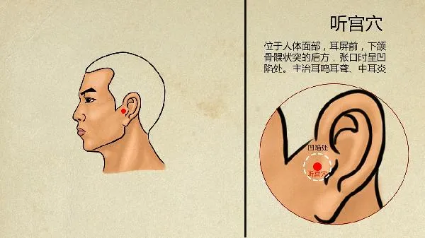 中医认为玫瑰痤疮是怎么得的
