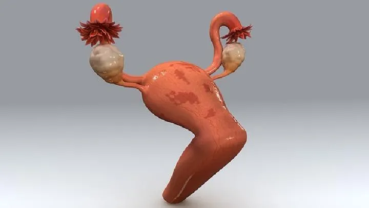 怎么检查有没有畸胎瘤