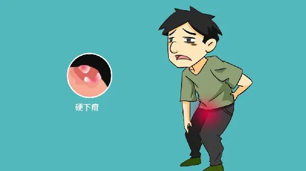 梅毒十种自我检查梅毒会痒吗