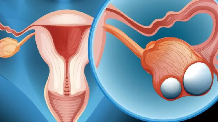 目前诊断子宫内膜癌的方法