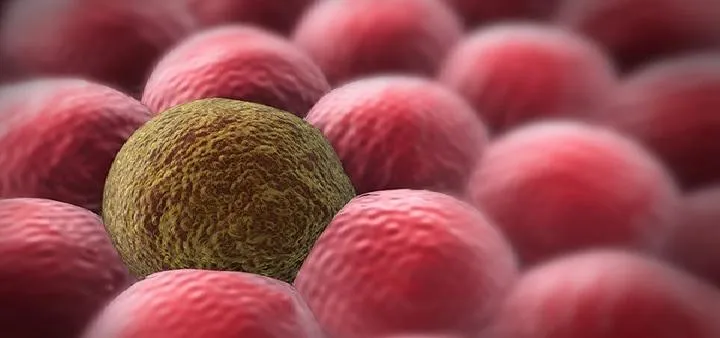 新冠肺炎怎么治疗 康复者血浆治疗法的作用及风险介绍