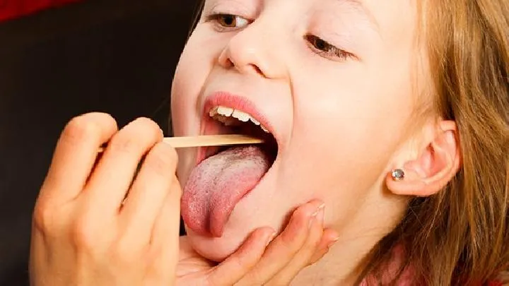 舌癌患者如何正确选择治疗方案