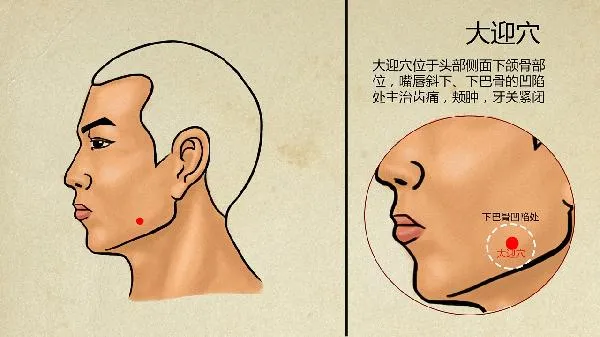中医认为玫瑰痤疮是怎么得的