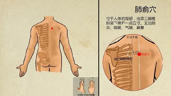 老年人出汗多中医怎么调理