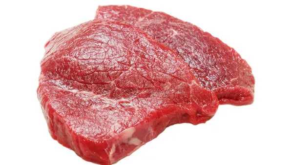 脑血栓病人吃什么好 脑血栓病人多吃这几种食物有助于缓解病情