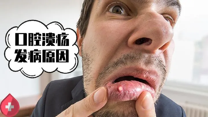 解读鹅口疮的几大诱因