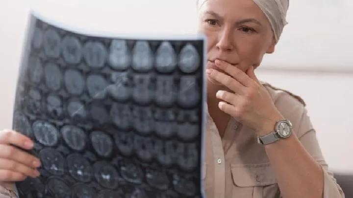 确诊脑出血需要做哪些检查