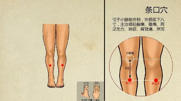 中医怎么治疗疱疹样皮炎