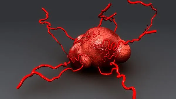 前庭大腺囊肿痒是怎么回事