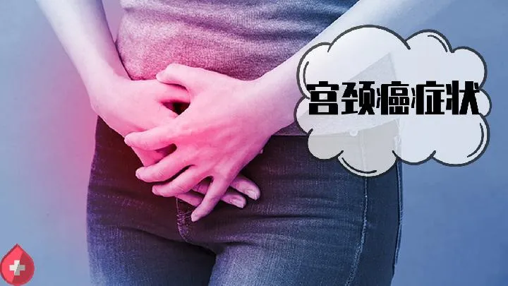 排卵障碍患者的护理禁忌