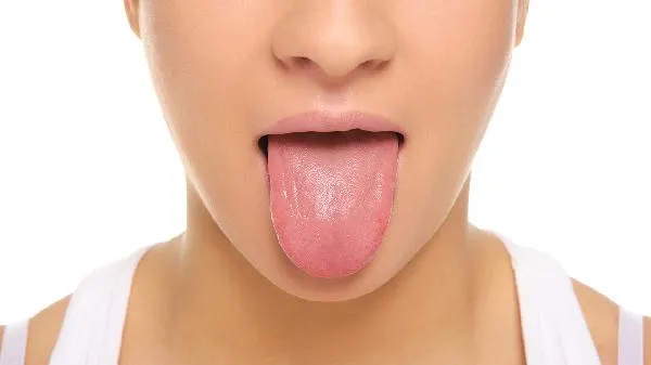 舌炎是由什么原因引起的
