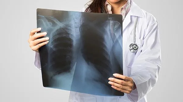 能和肺癌患者共用碗筷吗