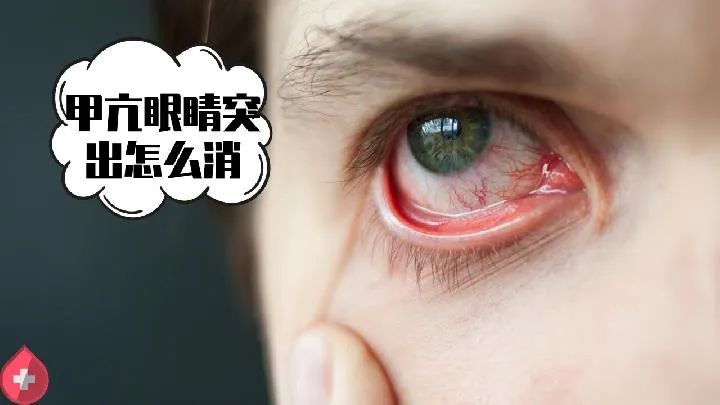 修护眼睛的保健小知识