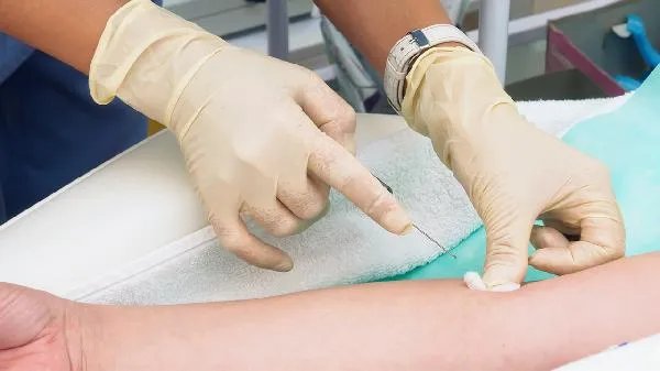 抽血测胆红素需要多久才能出结果