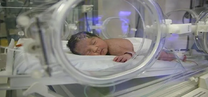 如何预防新生儿尿布疹 预防新生儿尿布疹的11建议