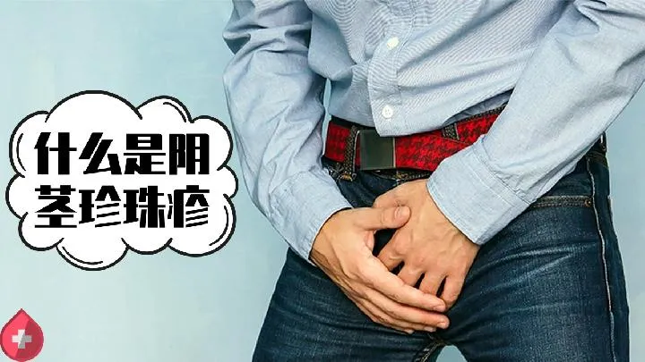 什么是新生儿脓疱病 新生儿脓疱病怎么办