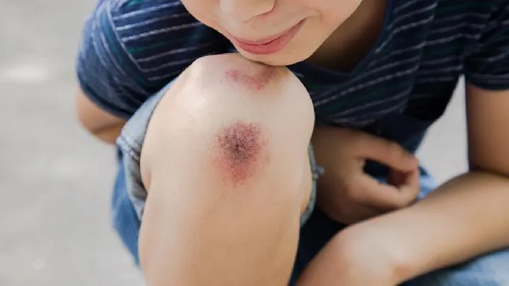 当心跷二郎腿跷出肥胖症