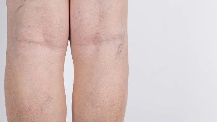 小孩睡觉蹬腿特别使劲