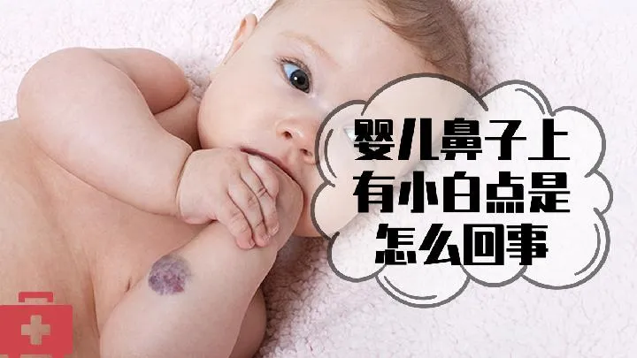新生儿斜视怎么治疗，新生儿斜视怎么治疗有效？