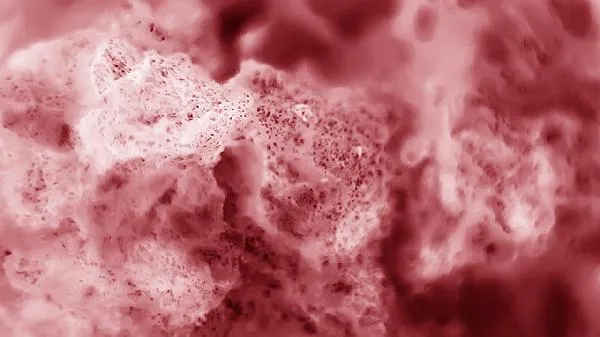 前庭大腺囊肿怎么消炎快点