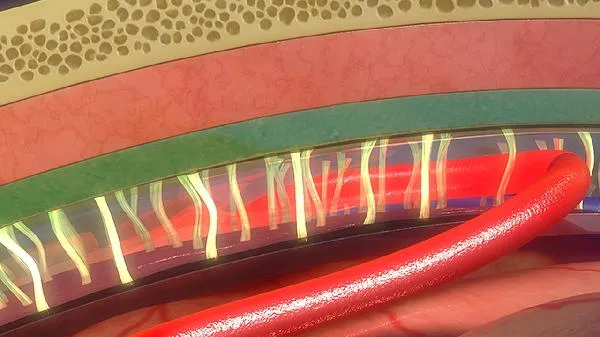 四肢血管彩超需要空腹吗