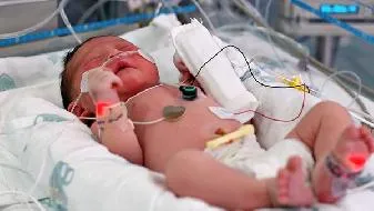 宝宝肚子大什么时候能恢复 3个方法预防宝宝肚子胀气