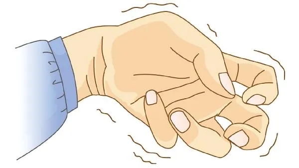 局灶性癫痫如何治疗