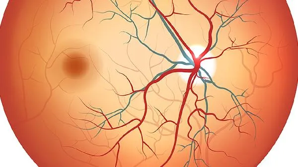 前庭大腺囊肿里面都是血块
