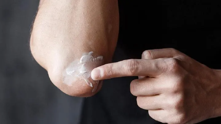 白化病治疗方法大全