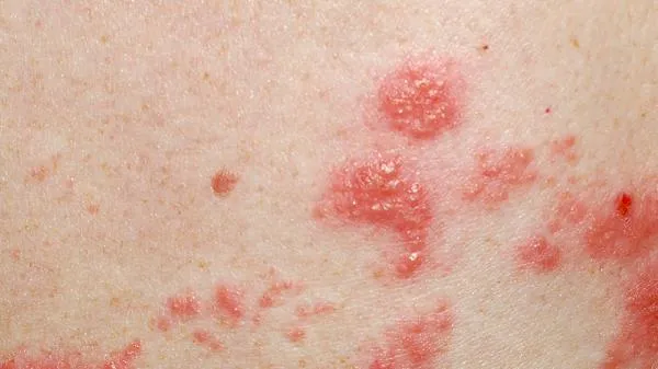 艾滋病没发病能检查出来吗