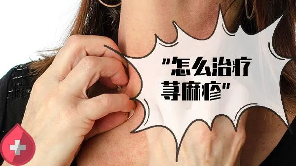 荨麻疹去医院挂什么科