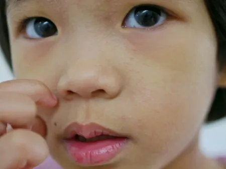 12岁小孩确诊胰腺癌晚期？妈妈后悔大哭：不该每天给她吃这个食物