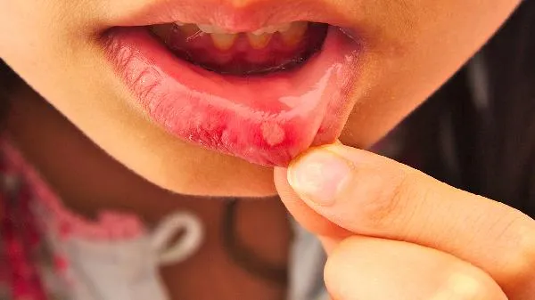 孩子肚子有虫子。去儿童医院挂什么科室？