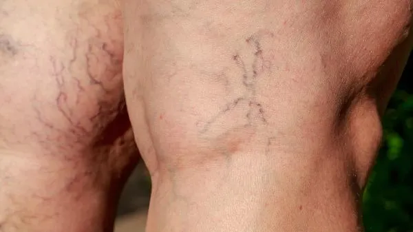 孩子成绩瘸腿的两大原因