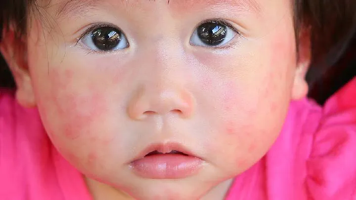 婴儿腹泻怎么办？小儿腹泻吃什么食物好？