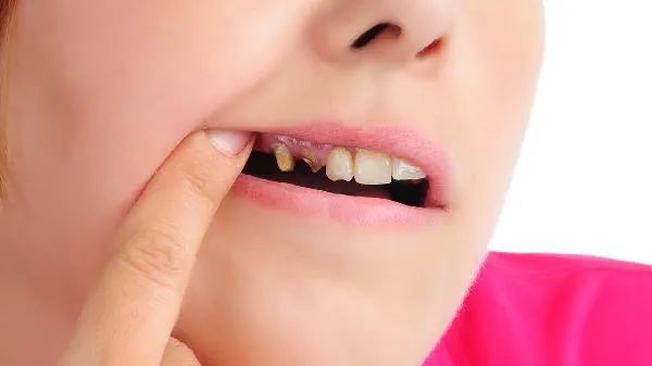 婴儿额头上经常有小红点怎么了？该怎么办？