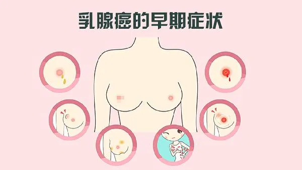 妊娠期用药易导致什么