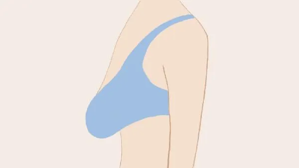 乳房下垂怎样恢复紧实