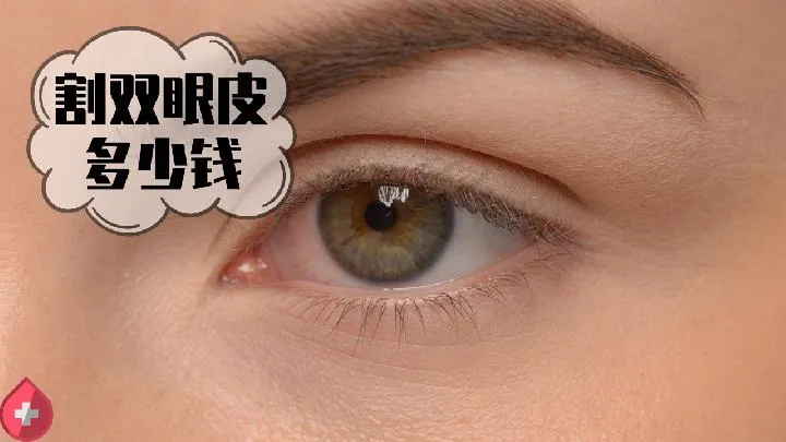 眼睛检查是结膜炎怎么办 如何治疗
