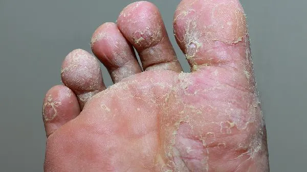 自我满足型人格的特点