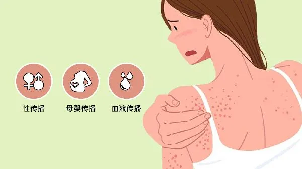 得了梅毒结婚会查出来吗