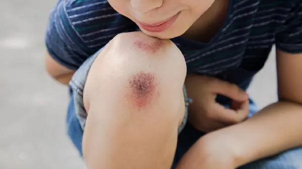 上台紧张手抖腿抖怎么克服
